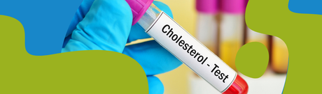Cholesterol: Causes, Symptoms & How to Lower It